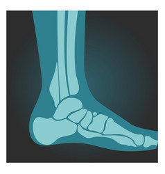 X-ray Shot Foot Side View Human Body Bones