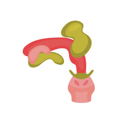 Pulmonary Aspiration Medical Infographics On White