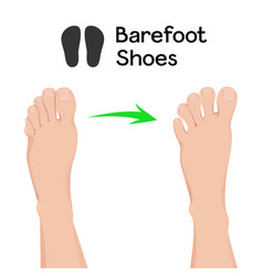 Compare Feet Before And After Barefoot Shoes