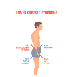 Crooked Man With Lower Crossed Syndrome Imbalance