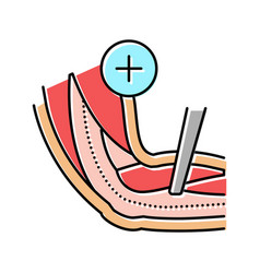 Ulnar Nerve Release Color Icon