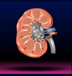 Kidney