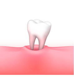 Tooth Loss On White Background