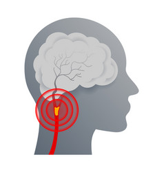 Cerebrovascular Disease Ischemic Icon