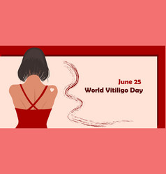 June 25 - World Vitiligo Day Pigmentation