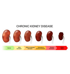 Chronic Kidney Disease Stage Of Disorder