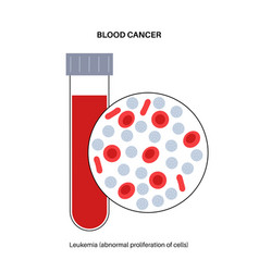 Leukemia Cancer Disease