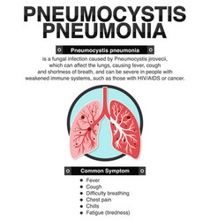 Informative Poster Of Pneumocystis Pneumonia