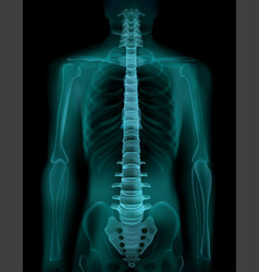 Spine X-ray Realistic Image