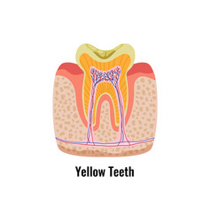 Dental Problems Poster