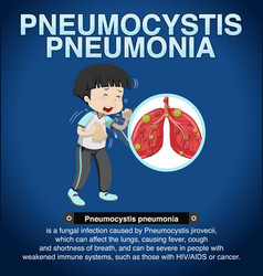 Informative Poster Of Pneumocystis Pneumonia