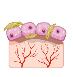 Subcutaneous Tick Skin Parasite