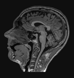 Realistic Image Sagittal Of Male Head With Ct Scan