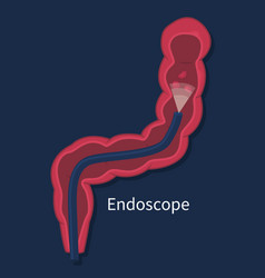 Endoscope In Colon With Polyps Screening