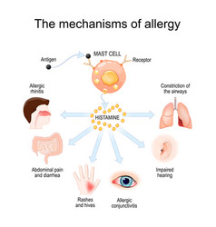 Mechanism Of Allergy Mast Cells And Allergic