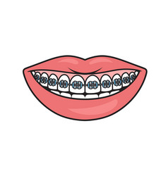 Dental Braces Schematic Medical