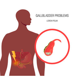 Medical Of The Bile Duct