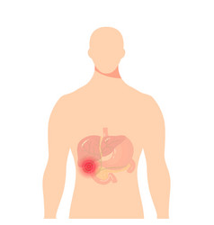 Medical Of The Bile Duct