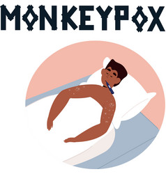 African Man Lying In Bed With Monkeypox