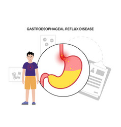 Gastroesophageal Reflux Disease