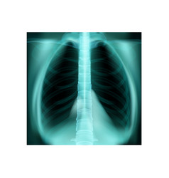 Lungs Radiogram Realistic Composition