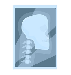 Xray Shoulder Scan Icon Cartoon Medical