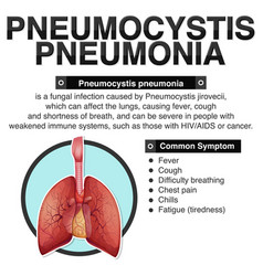 Informative Poster Of Pneumocystis Pneumonia