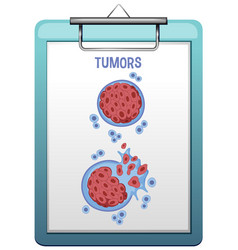 Tumor Cell And Cancer Development