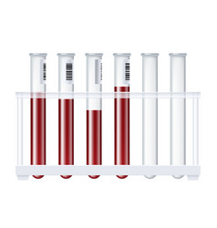 Blood Bottle Flasks Plasma Realistic Test Tube