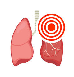 Pneumonia Asthma Lung Pulmonary Inflamed