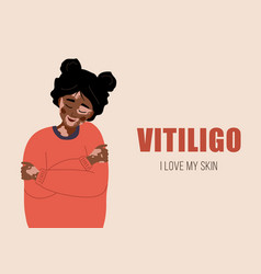 African Woman With Vitiligo Self Care