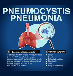 Informative Poster Of Pneumocystis Pneumonia