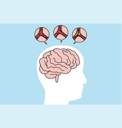 Medical Of Human Brain Stroke