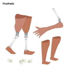 Set Of Prosthetic Leg Knee And Arm