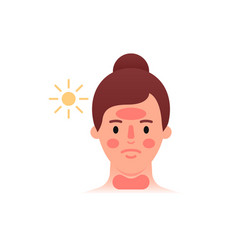 Sunburn Icon Woman With Red Face Flat Style