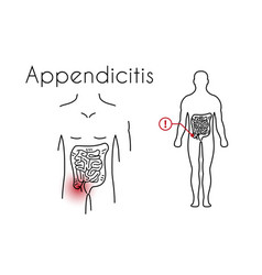 Appendicitis Linear Icon Young Man