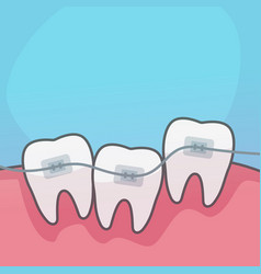 A Dental Braces Fixing Teeth Flat Design