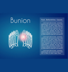 Bunion In Foot Background