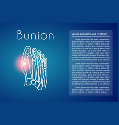 Bunion In Foot