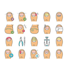 Ingrown Nail Disease Collection Icons Set