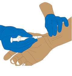 Arterial Blood Gas Sampling