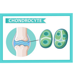 Informative Poster Chondrocyte