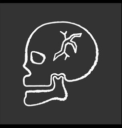 Skull Fracture Chalk White Icon On Black