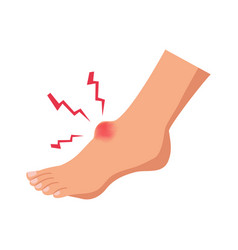 Flat Foot Injury