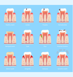 Different Types Of Dental Disease Treatment