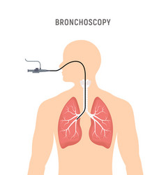 Bronchoscopy Respiratory System Emphysema