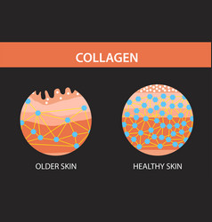 Collagen Older Skin And Hearlthy Skin