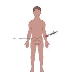 Harvesting Bone Marrow From The Donor