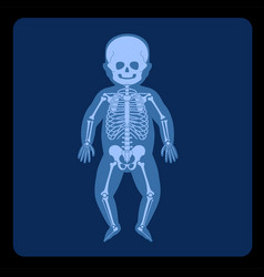 Skeleton X Ray