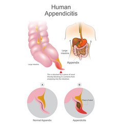 Excretion Vector Images (over 160)